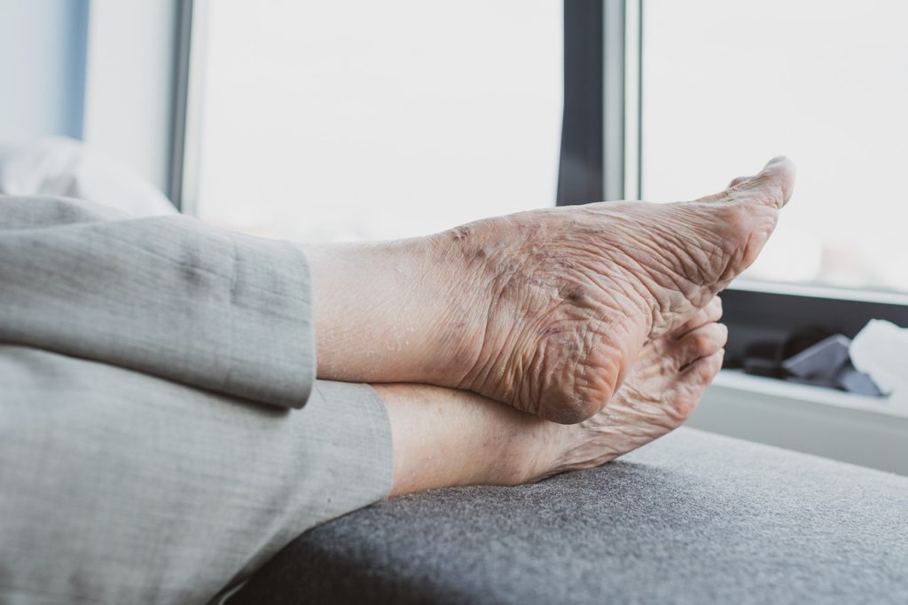 Chevilles enflées chez les personnes âgées
